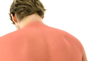 Getting even one bad sunburn every two years increases the likelihood of skin cancer by three times.