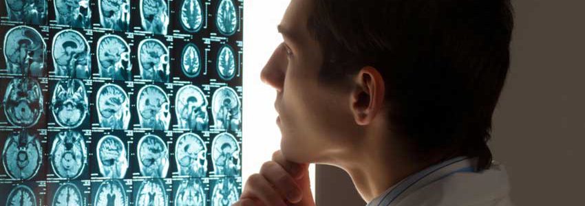 Understanding of traumatic brain injuries, or TBIs